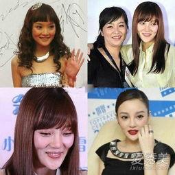 整容的明星后遗症,美丽代价背后的隐忧